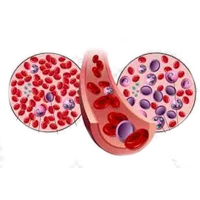 Blood Cancer Ayurvedic Treatment